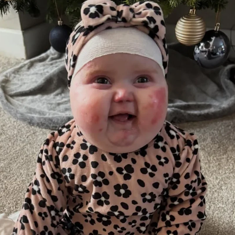 Ajude a pequena Vivi — Acabe com a dor dela
