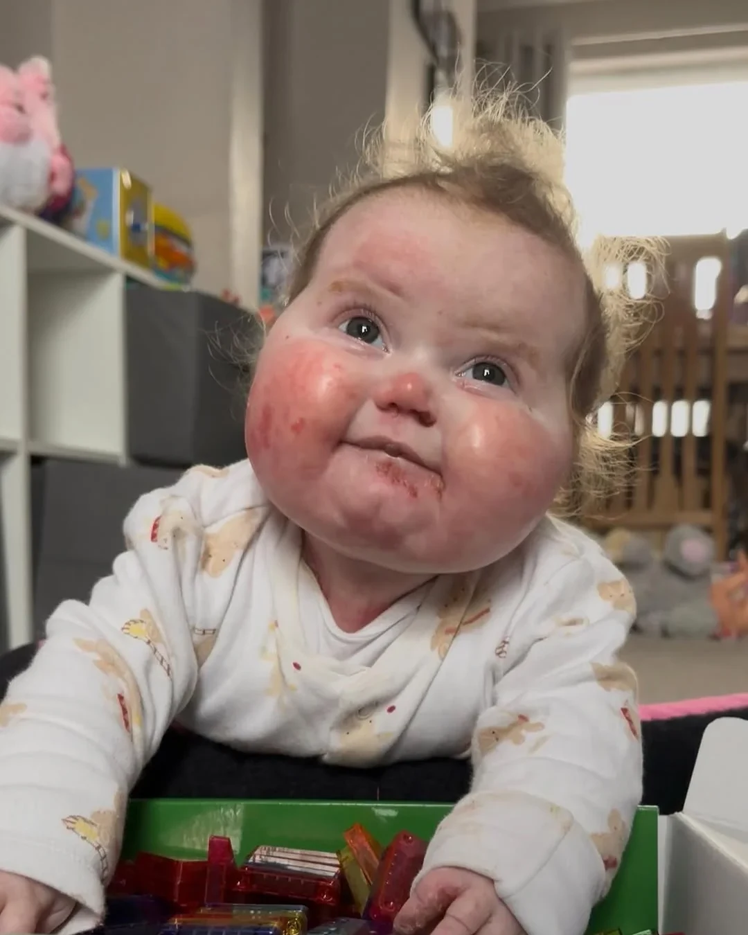 Vivi brincando apesar das lesões